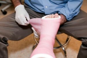 hire a car accident attorney in baltimore if you received major injuries, like a broken leg shown in this picture with a pink cast going on 